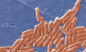 Colonia de la bacteria salmonela. (Foto: Janice Haney Carr | CDC)
