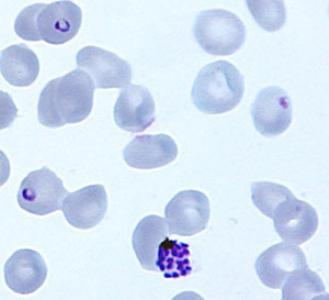 El 'Plasmodium falciparum' visto bajo el microscopio. (Foto: GSK)