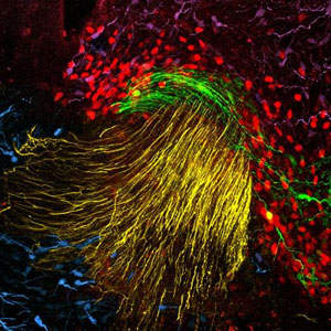 Neuronas (en rojo) que expresan el gen OTP. (Foto: CSIC)
