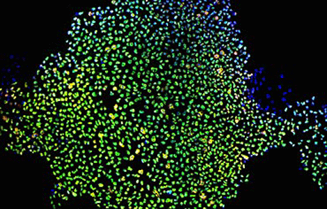 Clulas madre inducidas de piel adulta. (Foto: NIGMS | NIH)