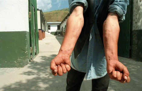 Un toxicómano muestra sus brazos a las puertas de la narcosala. | Chema Tejada