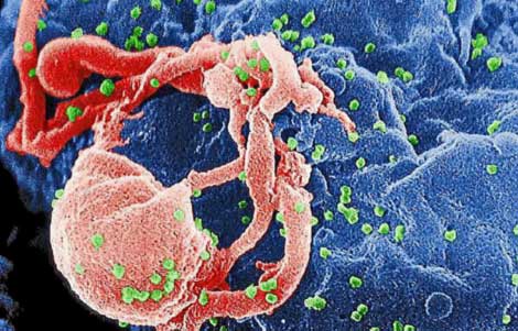 El VIH uniéndose a un linfocito.| CDC