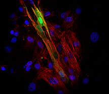 Clulas madre cardiacas de cerdo (verde), diferenciadas a cardiomiocitos.| A. Izarra