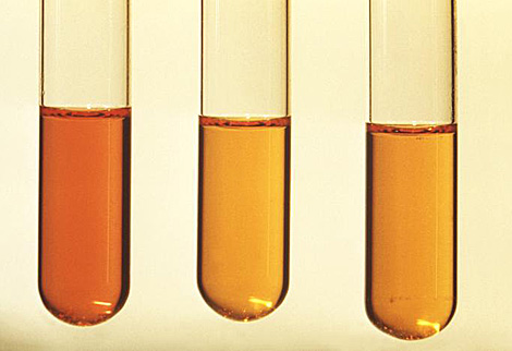 Tres tubos de análisis.| CDC | David Berd