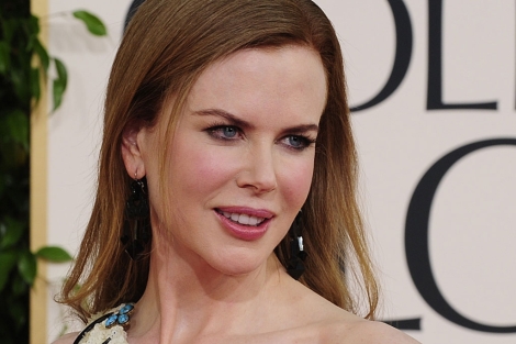 Nicole Kidman ha confesado el uso de Btox.| AFP