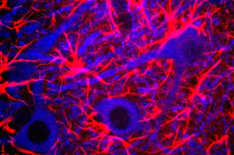 Neuronas del hipocampo de una rata. | Science