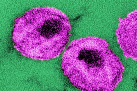 Partículas del virus del VIH.| CDC | Harrison y Feorino