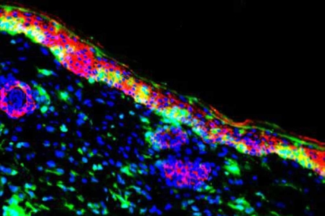 Las clulas de la mdula sea (en color verde) pueden regenerar la piel. | Osaka University