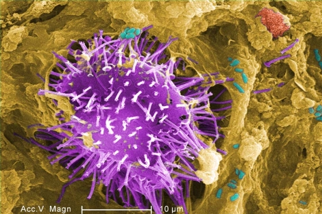 Bacteria de E. coli | Janice Haney Car. | CDC