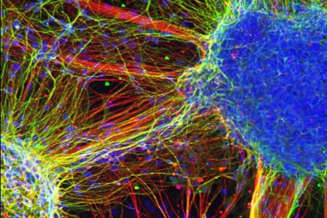 Neuronas derivadas de los pacientes esquizofrénicos.| Nature