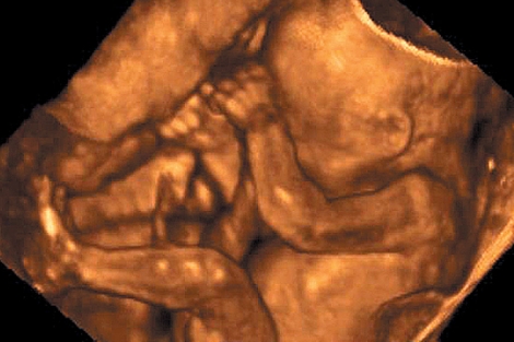 Imagen de un feto de 21 semanas. | El Mundo