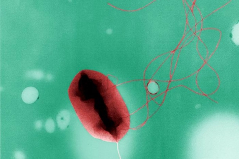 Imagen de la bacteria 'Escherichia Coli'.| CDC | Elizabeth H. White