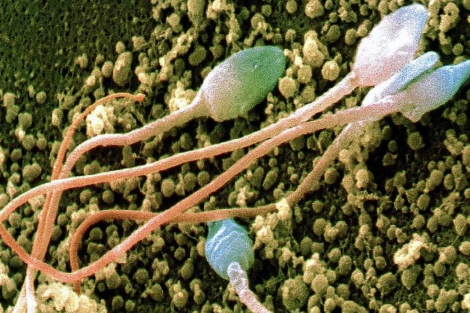 Espermatozoides humanos vistos al microscopio. | Science