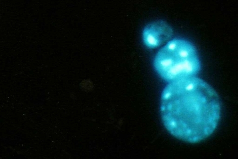 Imagen de un telmero (fragmentos de ADN que se encuentran en los extremos de los cromosomas). El Mundo