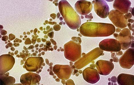Un conjunto de nanopartculas vistas al microscopio. | Foto: Science Photo Library