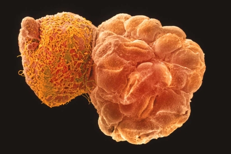 Imagen de un embrión de cinco días en fase de blastocisto. | Science Photo Library