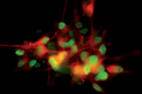 Neuronas generadas a partir de la piel de una persona con Parkinson. | Foto: U. de Edimburgo.
