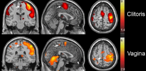 El cerebro se activa de manera diferente según el área estimulada. | Foto: Barry Komisaruk