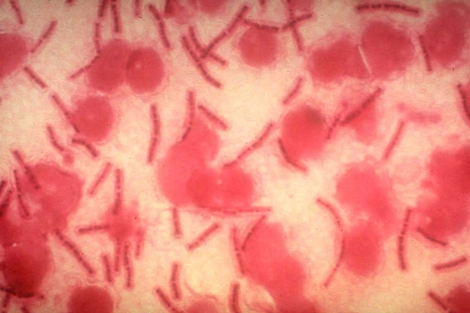 Imagen de la bacteria de ntrax. | El Mundo
