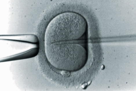 La microinyección espermática es la técnica aconsejada en las parejas con hepatitis C. | IVI