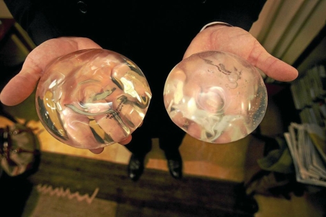 Implante de silicona usado en aumento de pecho. | AFP
