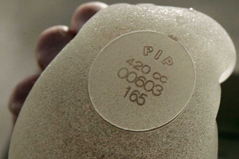 La silicona defectuosa utilizada en las prótesis.| Reuters