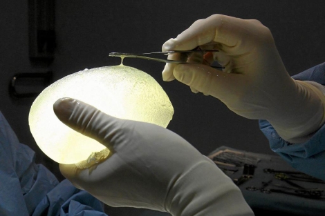 Un cirujano sujeta un implante de silicona defectuosa PIP. | Reuters