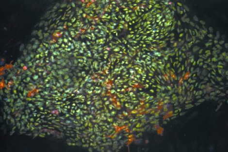 Clulas madre de origen embrionario. | NIH