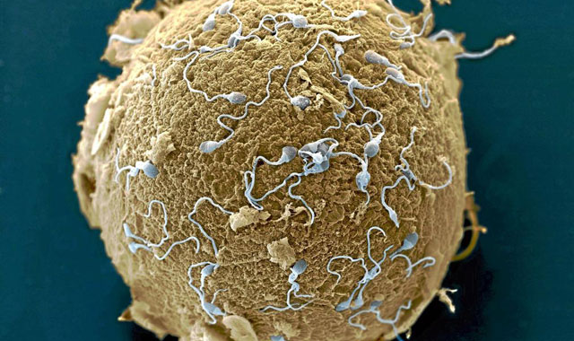 Un vulo rodeado de espermatozoides. | Science Library