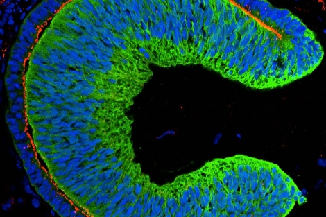 Copa óptica creada a partir de células madre embrionarias | Nakano et al. | Cell Stem Cell