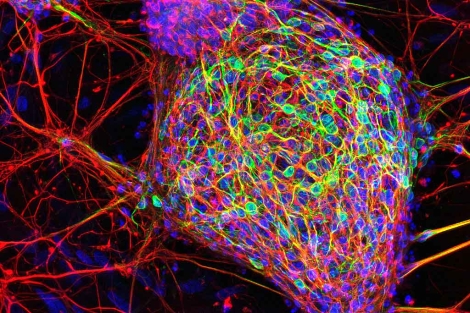 Imagen de las neuronas obtenidas en el experimento.| CMRB