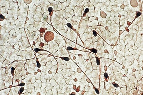 Imagen de espermatozoides humanos. | Facultad de Medicina de la U. de Utah