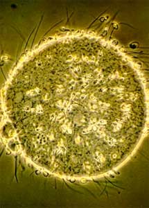 Espermatozoides intentando entrar en un vulo. | Universidad de Utah