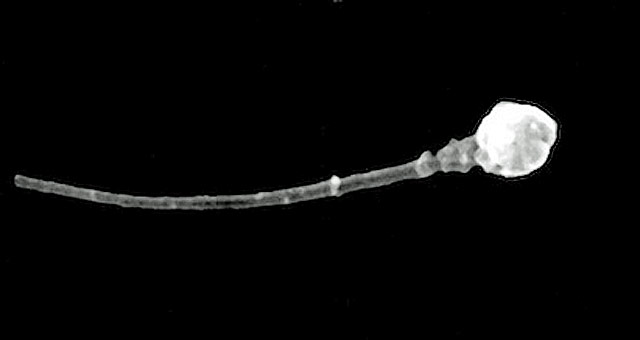 Imagen microscópica de un espermatozoide. | Universidad de Utah