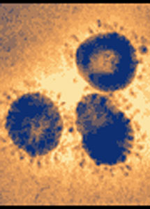 Virus del SRAS, un tipo de coronavirus. | CDC