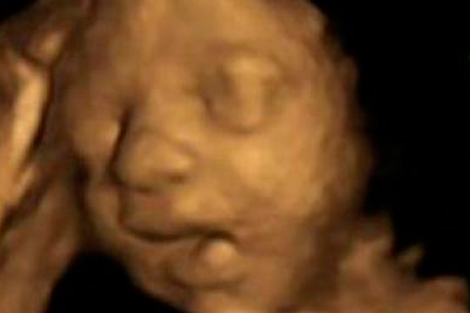 Un feto bosteza en la semana 27 de gestacin.|PLoS ONE