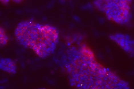 Células madre utilizadas para los estudios de anemia de Fanconi. | CIEMAT