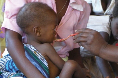 La desnutricin infantil es un problema importante en Malawi. | Tanya Yatsunenko