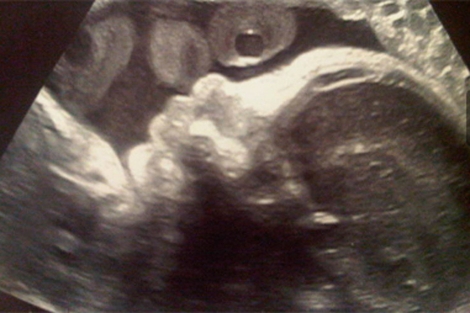 Imagen de un feto a través de una ecografía