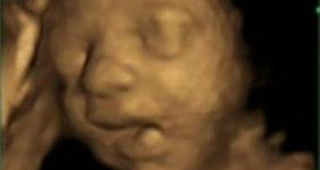 Un feto bosteza en el interior del útero materno