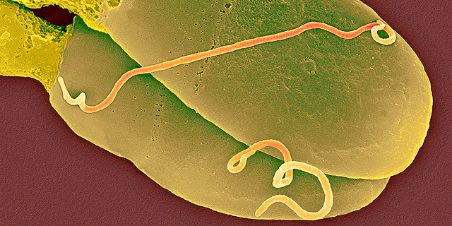 Una cabeza de espermatozoide con la bacteria que causa la sífilis