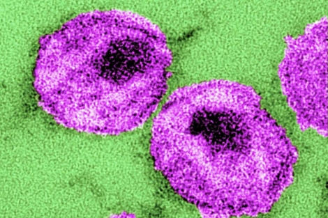 Varias partículas del virus del VIH.