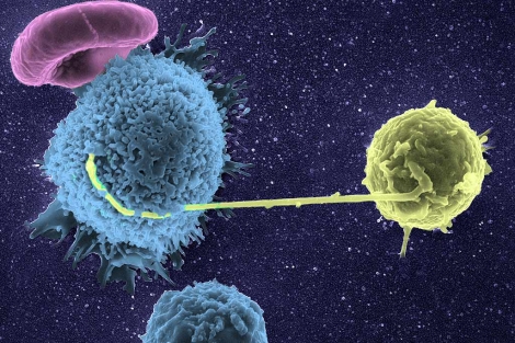 Imagen microscópica de un linfocito infectado por el VIH (en amarillo), extiendiendo una membrana hacia otro sano (en azul).| Institut Pasteur