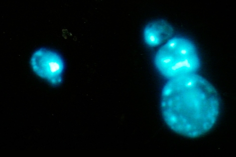 Imagen al microscopio de unos telómeros dañados. | Universidad de California | Efe