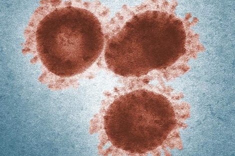 Virus de la familia de los coronavirus. | CDC