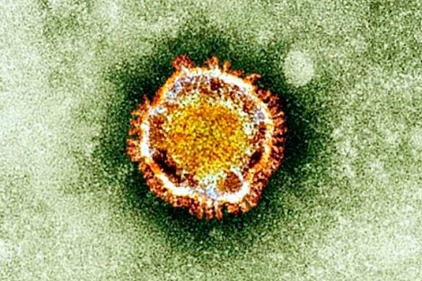 Una imagen al microcopio del virus.| Afp