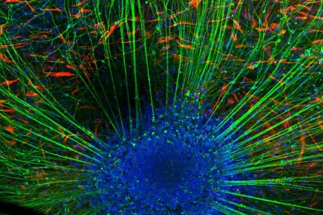 Neuronas obtenidas a partir de células madre de cordón.