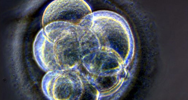 Embrión humano.