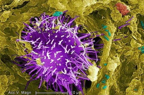 Imagen al microscopio de una bacteria 'E. coli' en el intestino.| CDC