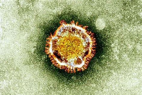 Detalle de una cepa de coronavirus. | Afp